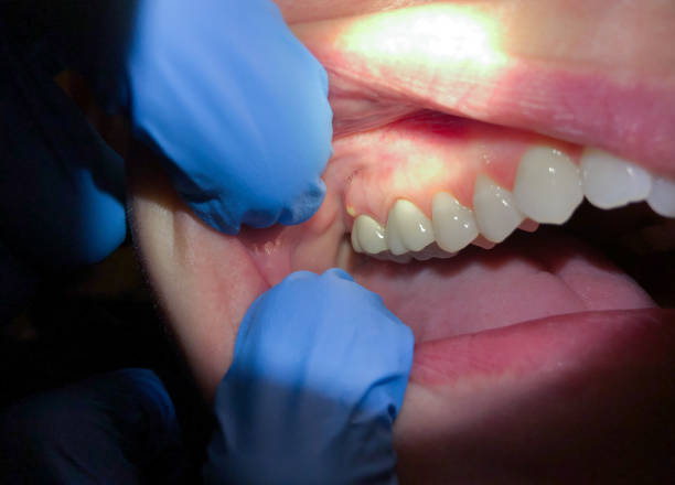 Best Orthodontic Emergency Dentist in North Braddock, PA